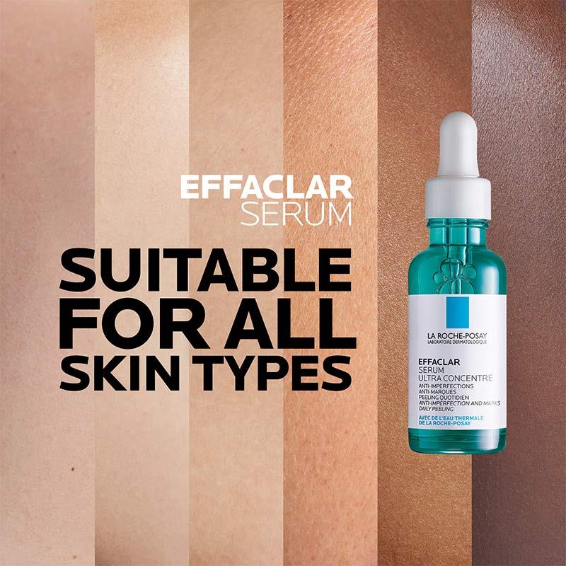 Serum cô đặc La Roche Posay Effaclar Ultra 30ml