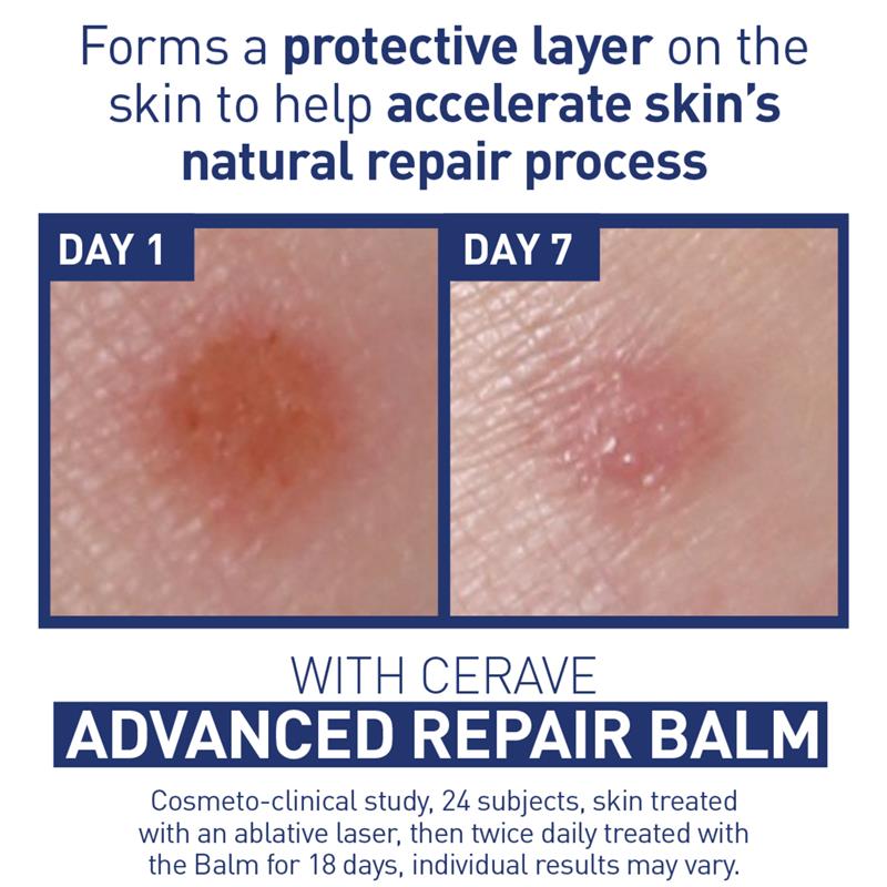 Kem dưỡng phục hồi da CeraVe Advanced Repair Balm 50ml