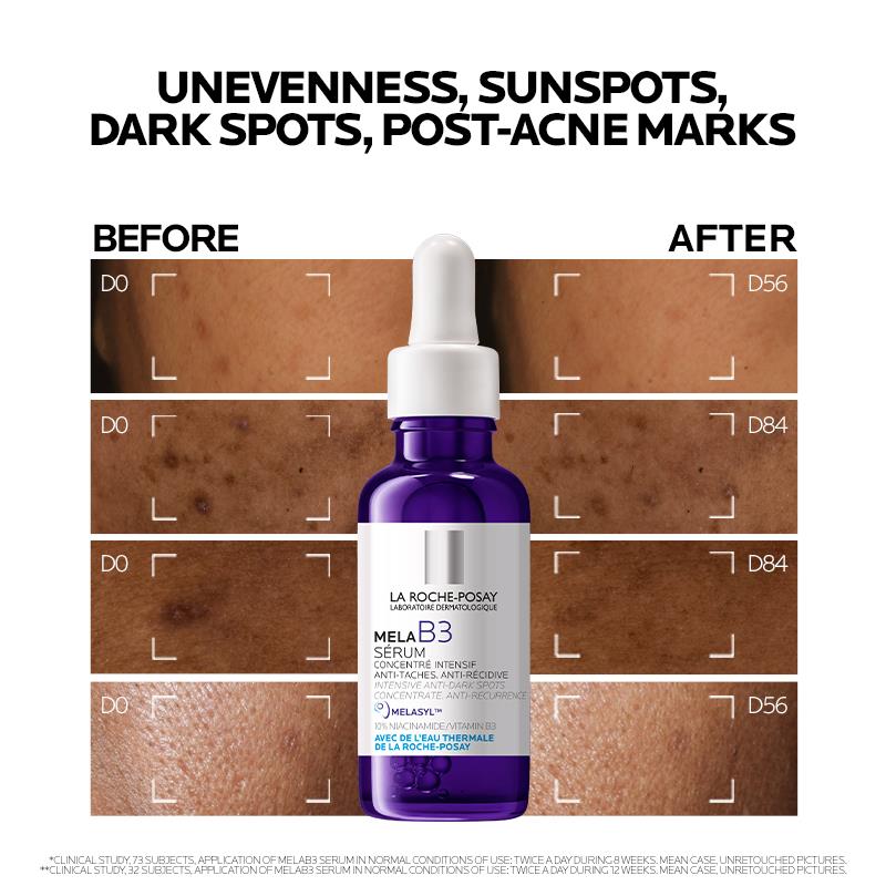 Serum La Roche Posay Mela B3 30ml