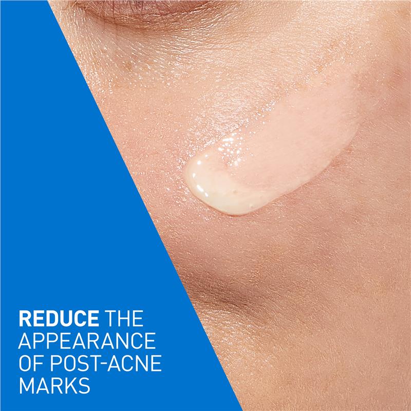 Huyết thanh Retinol kiểm soát mụn CeraVe 30ml
