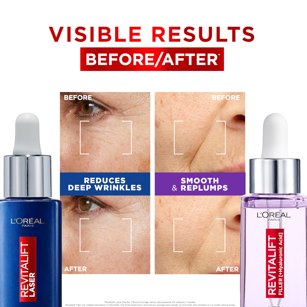 L'Oreal Paris Power Serums Revitalift Filler and Laser Day & Night Gift Set