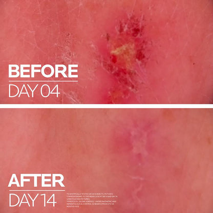 理肤泉 Cicaplast Baume B5+ 100ml 