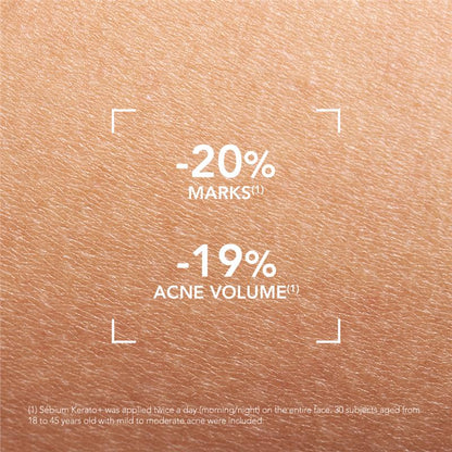 Kem dưỡng ẩm Bioderma Sebium Kerato Nonallergenic Acne Cream phù hợp với da mụn 30ml 