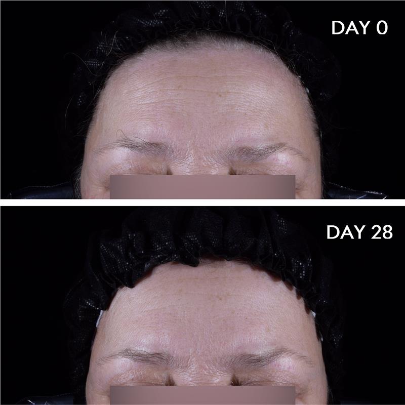 Serum dưỡng ẩm Bioderma Hydrabio Hyalu + Hydrating Plumping với Hyaluronic Acid và Niacinamide 30ml 