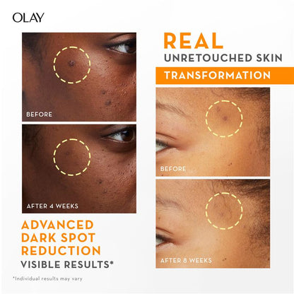 Olay Luminous Vitamin C Super Serum 30ml
