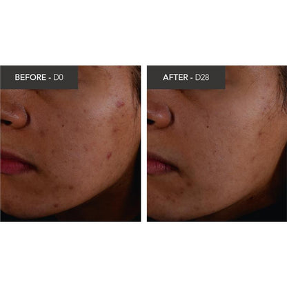 Kem dưỡng ẩm Bioderma Sebium Kerato Nonallergenic Acne Cream phù hợp với da mụn 30ml 